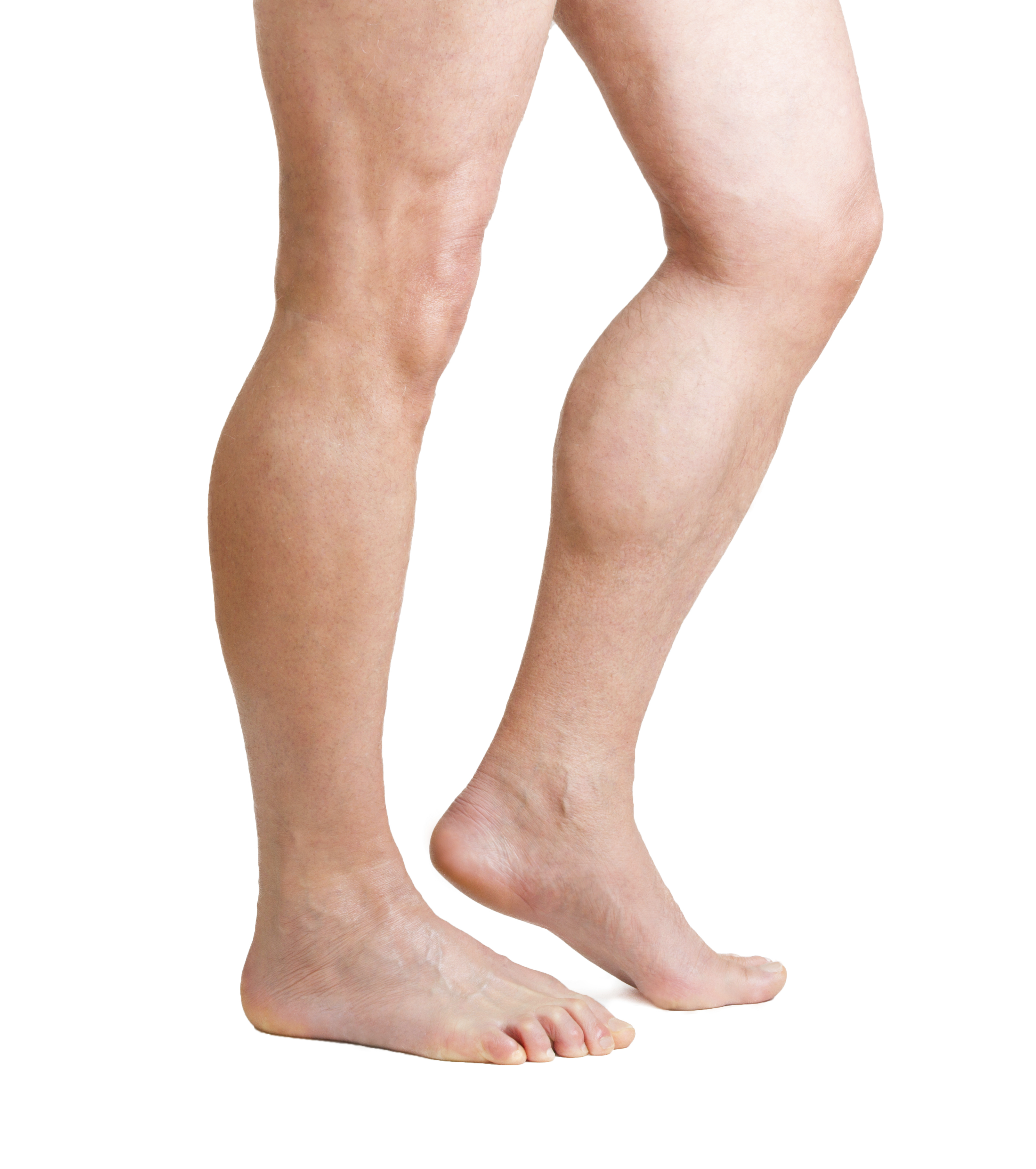 Olney Varicose Vein Doctor: Veins & Health